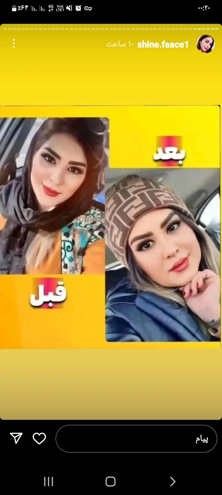 تپلی صورت آرایشی مراقبتی - لوازم آرایشی و بهداشتی در تهران - تصویر 2