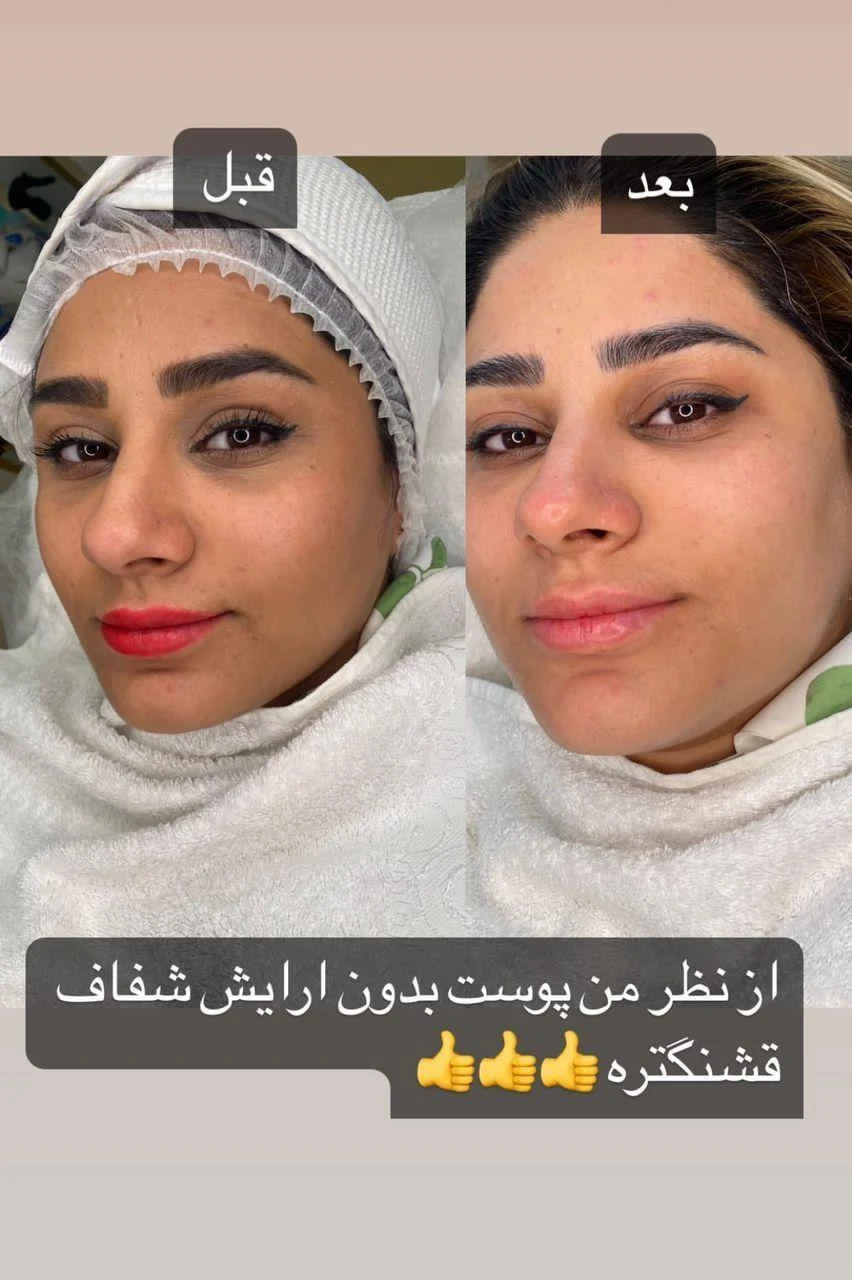 مرکزتخصصی پوست مو مژه و ابرو مهروبیوتی - آموزشگاه آرایشگری در تهران - تصویر 4