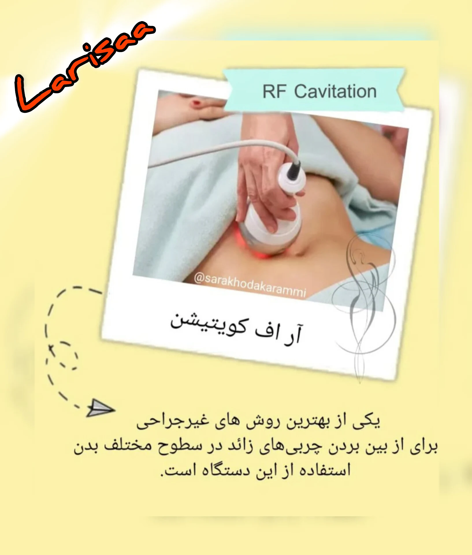 لاغری موضعی در ۸جلسه در لاریسا اسلیمینگ - کلینیک لاغری در تهران - تصویر 2