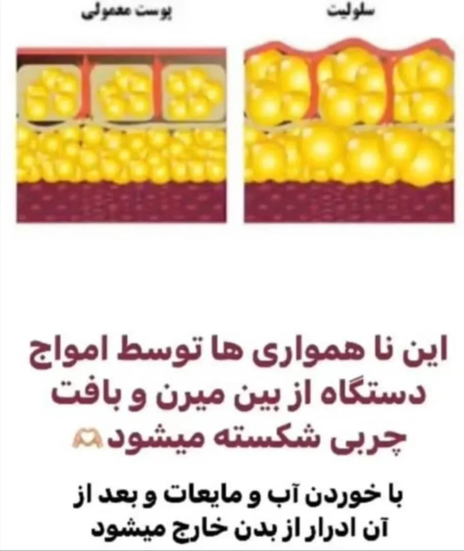 لاغری موضعی در ۸جلسه در لاریسا اسلیمینگ - کلینیک لاغری در تهران - تصویر 4