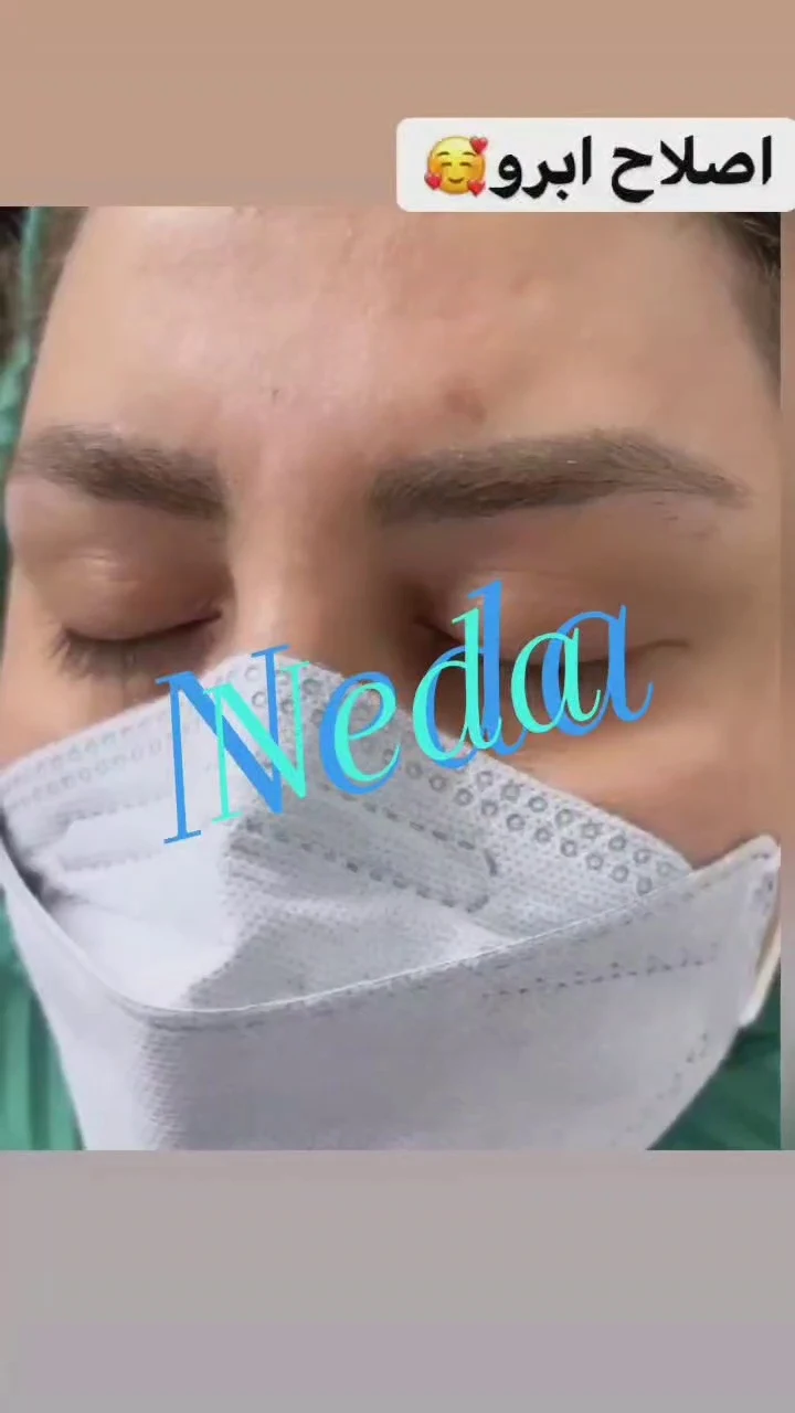 اصلاح ابرو و اپیلاسیون ندا - تصویر 2