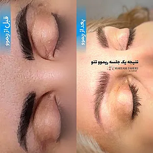 مرکز زیبایی لیلیان