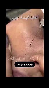 خدمات تخصصی فیشال و پلاسماجت نگین