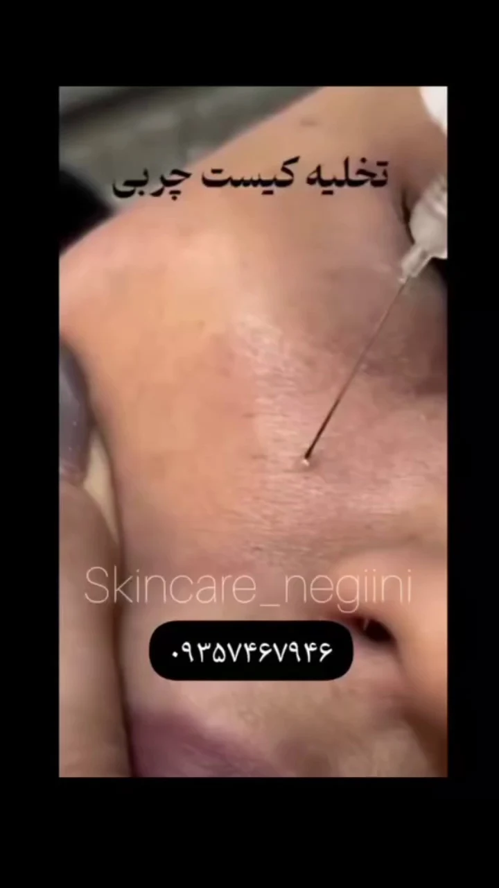 خدمات تخصصی فیشال و پلاسماجت نگین - آرایشگاه زنانه در تهران