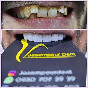 کلینیک دندانپزشکی جاسم پوردنت
