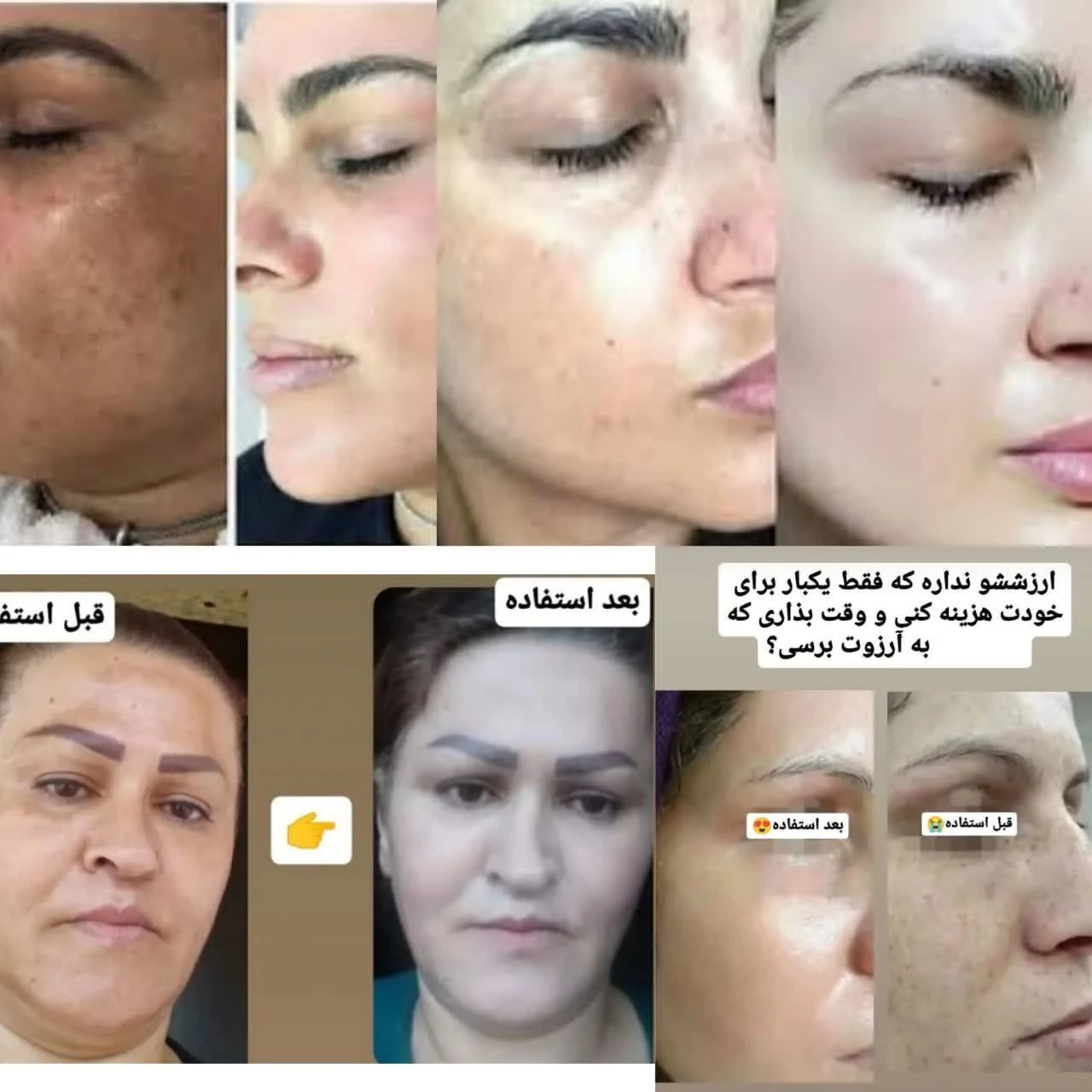 کرم ضدلک وسفیدکننده vip - لوازم آرایشی و بهداشتی در تهران