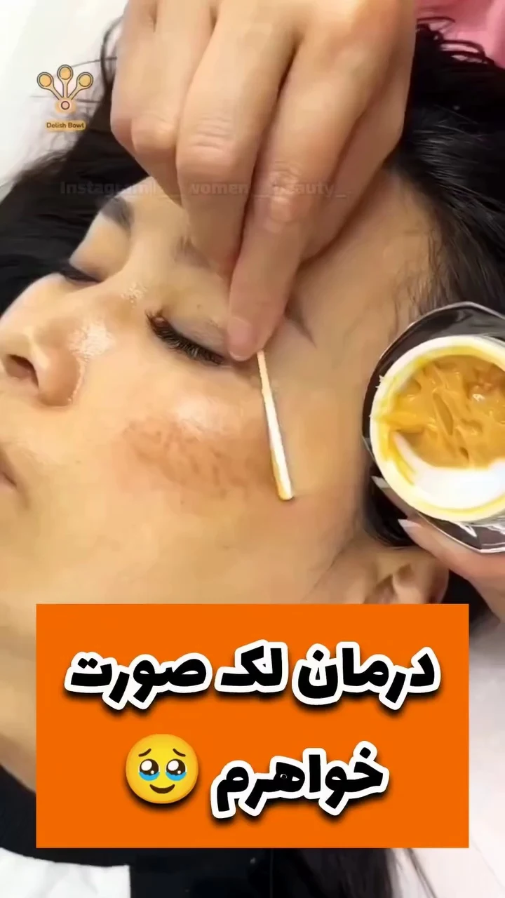 کرم ضدلک وسفیدکننده vip - لوازم آرایشی و بهداشتی در تهران - تصویر 4