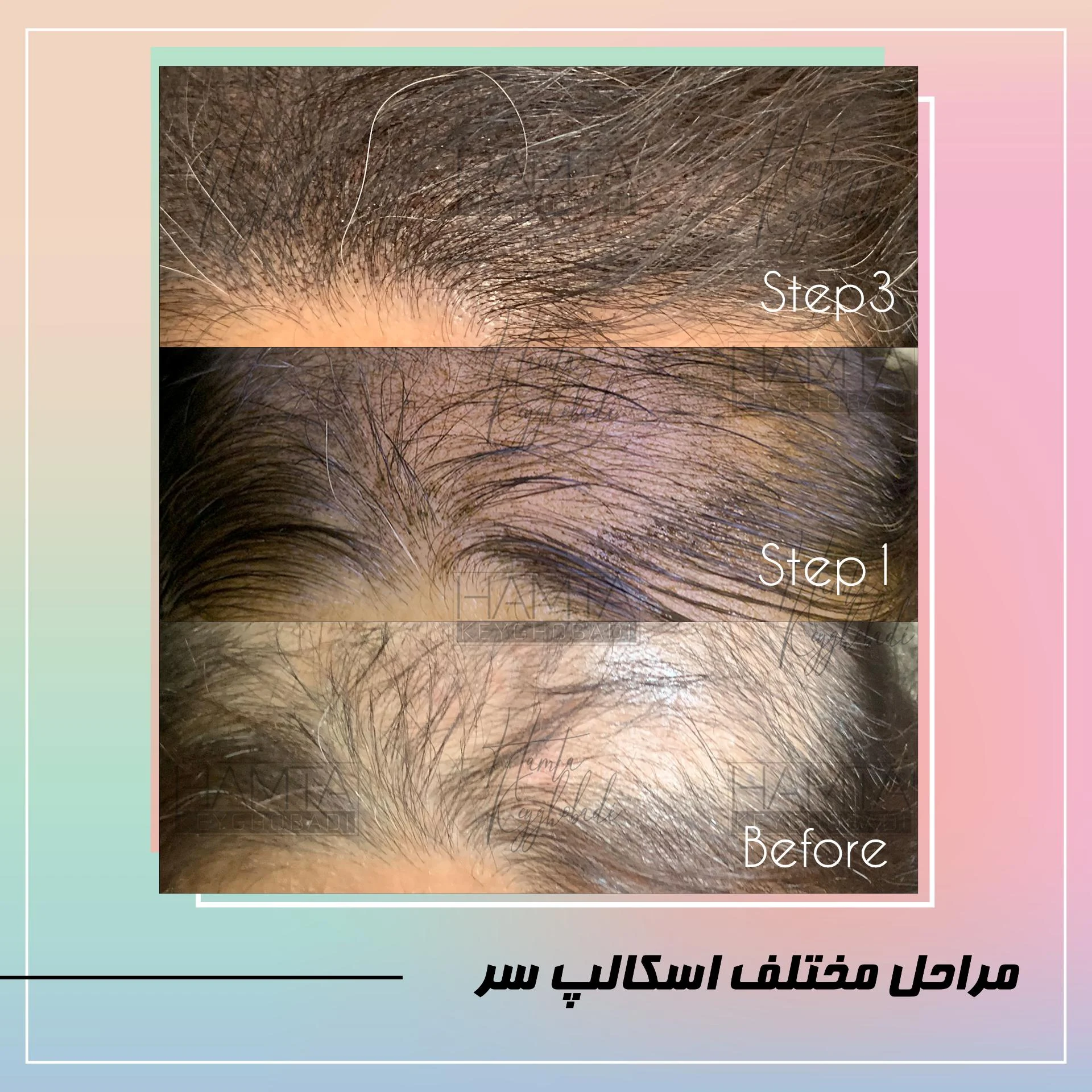 سالن زیبایی همتا کیقبادی - آموزشگاه آرایشگری در تهران - تصویر 3