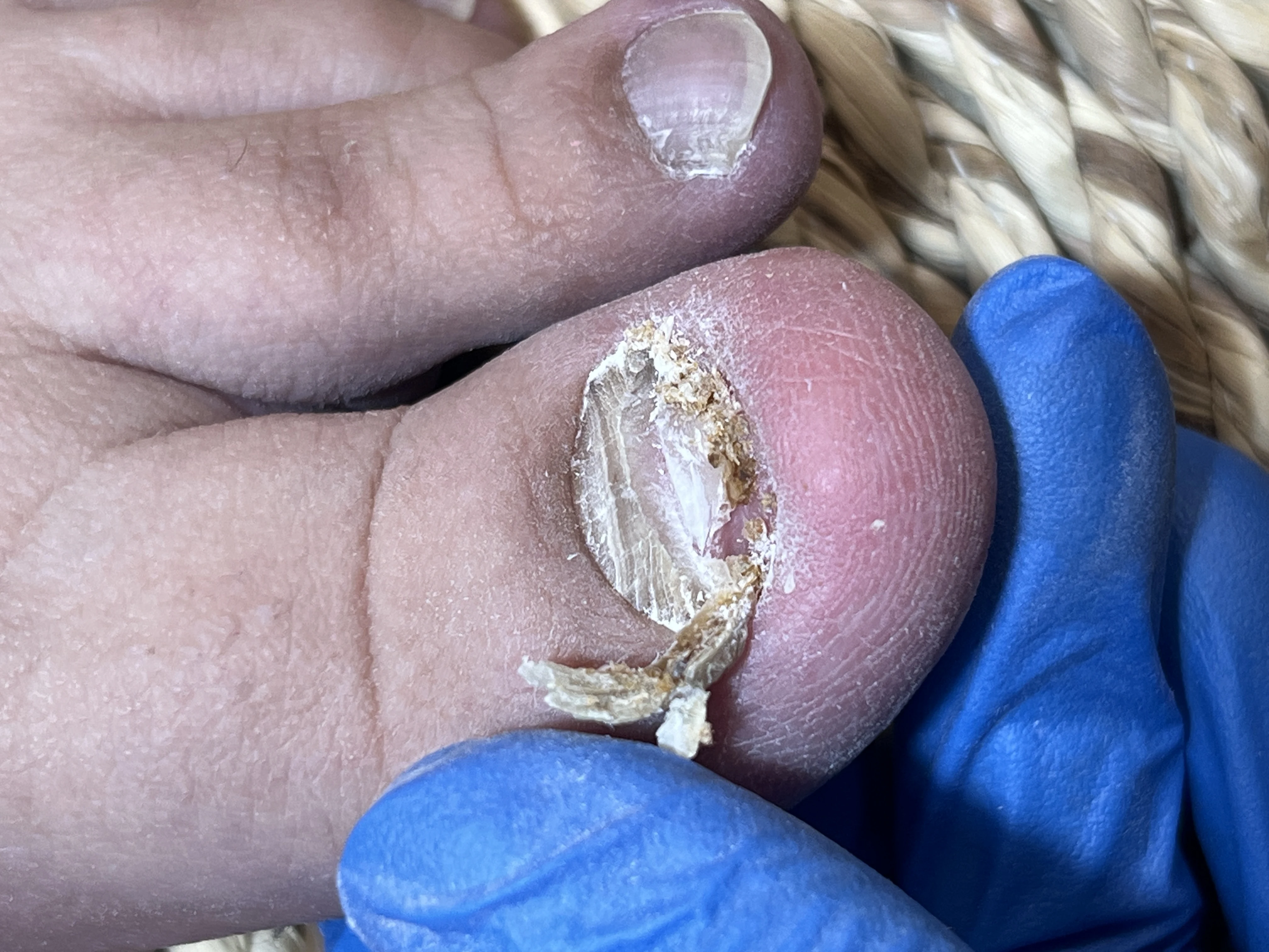 خدمات تخصصی پدیکور و پودولوژی با فروغ - تصویر 4