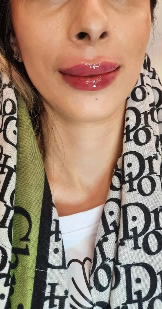 مطب پوست ومو و زیبایی  دکتر عاطفه بیرامی - کلینیک پوست و زیبایی در تهران
