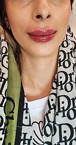 مطب پوست ومو و زیبایی  دکتر عاطفه بیرامی
