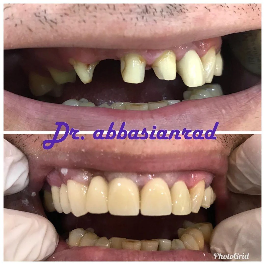 کلینیک دکتر عباسیان - دندانپزشک در تهران - تصویر 3