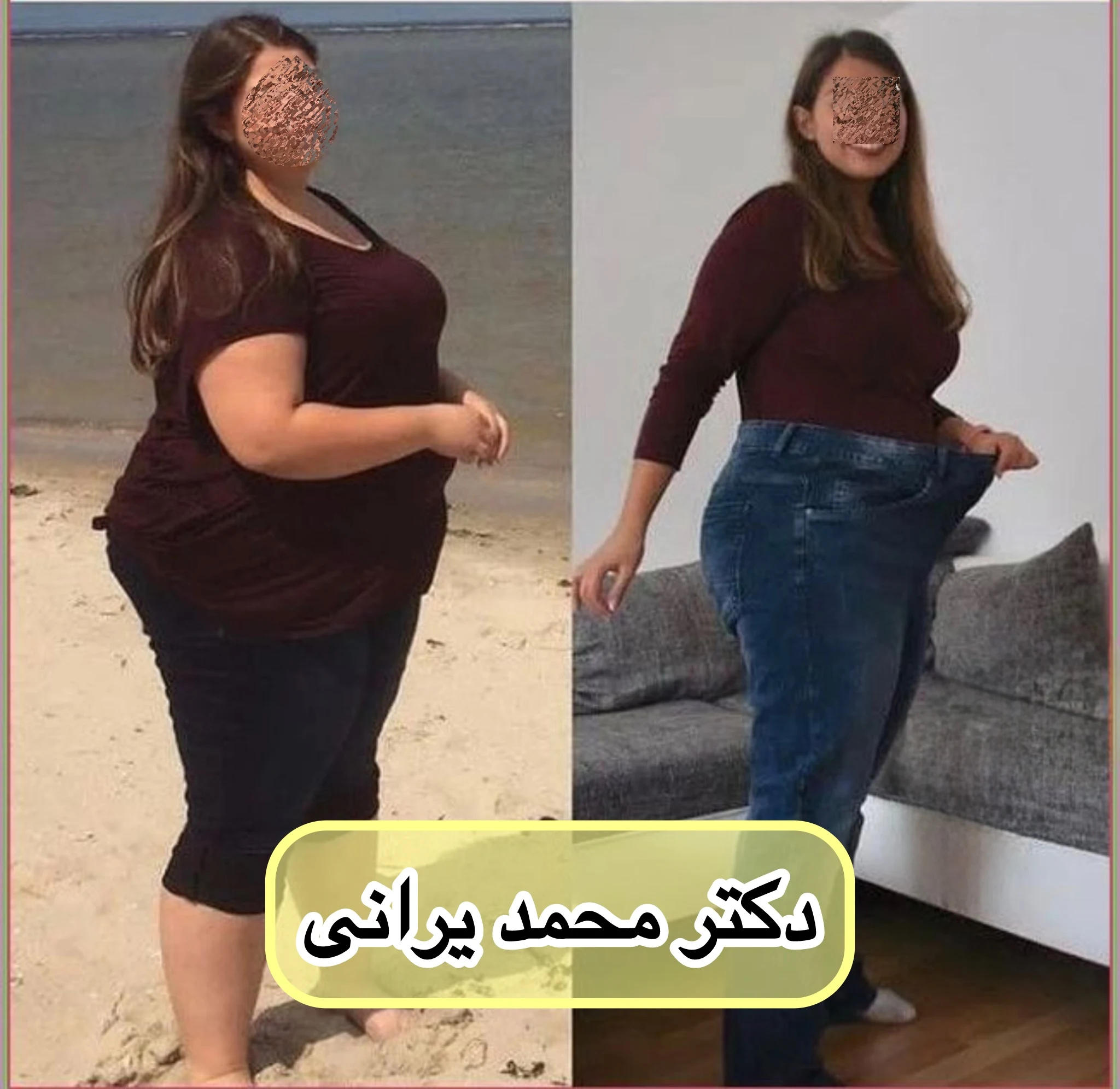 فلوشیپ فوق تخصصی جراحی ( اسلیو بایپس) - تصویر 3
