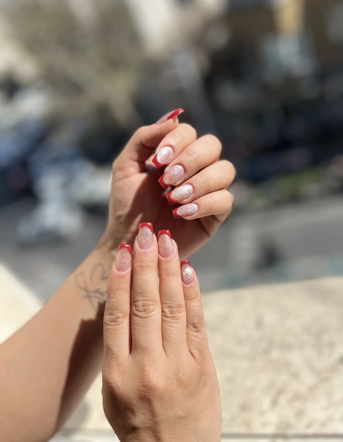 کاشت و ترمیم ستایش - تصویر 2