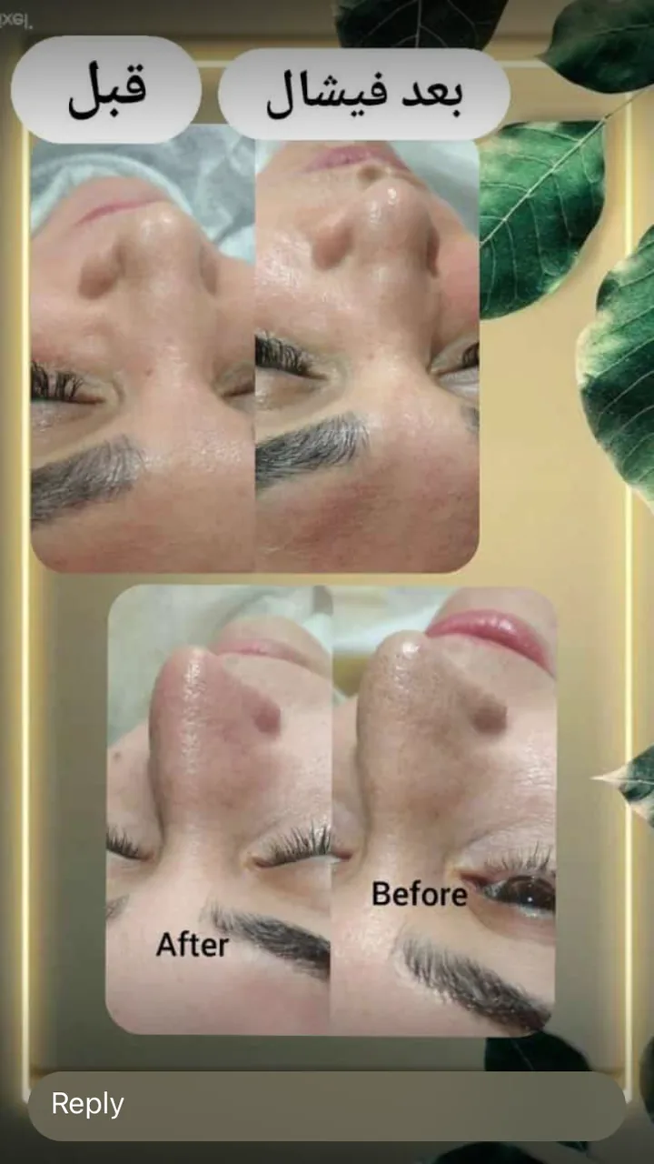 خدمات تخصصی ناخن مژه فشیال تتوصورت شفیعی - تصویر 4