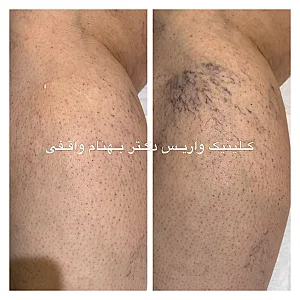 کلینیک تخصصی درمان واریس دکتر واقفی