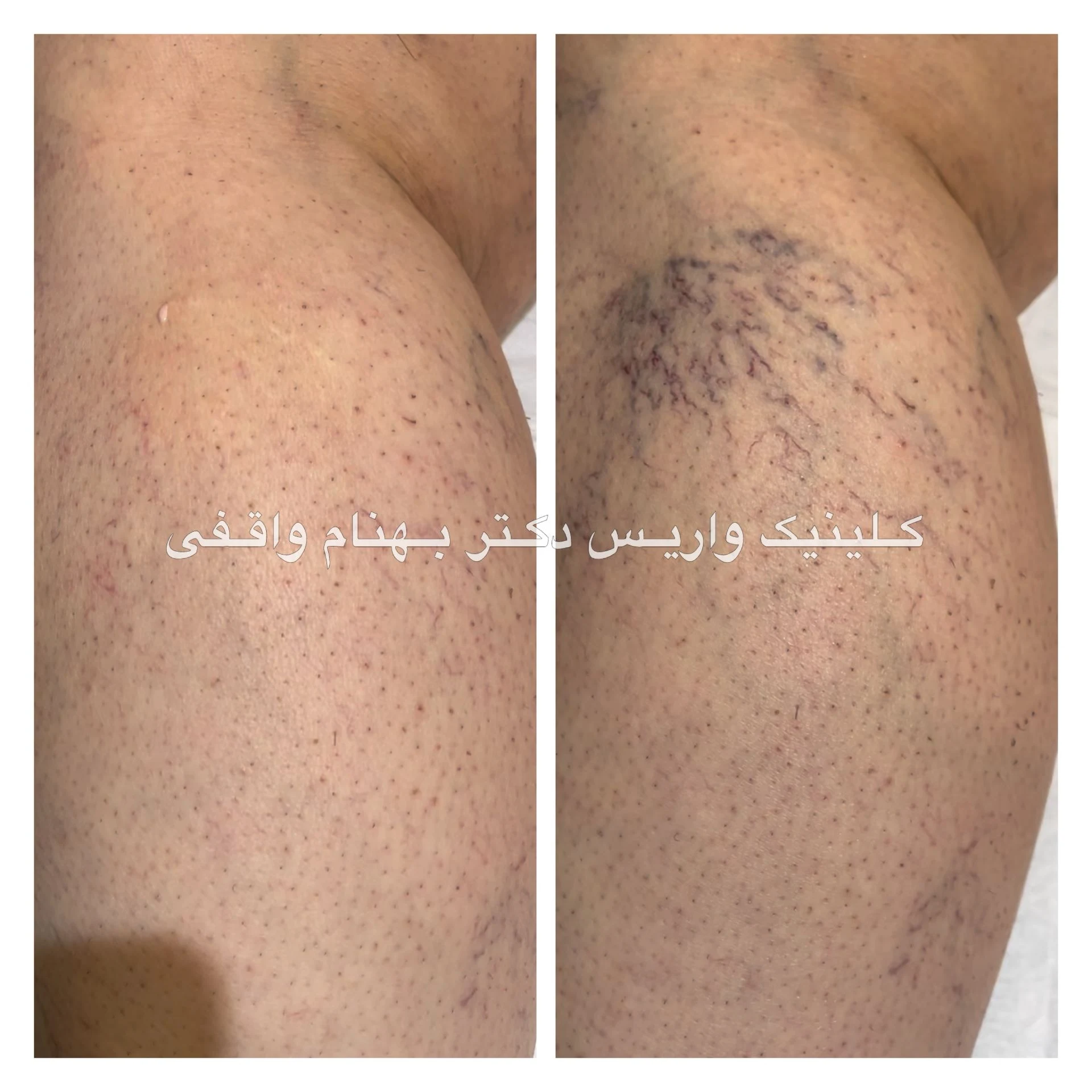 کلینیک تخصصی درمان واریس دکتر واقفی