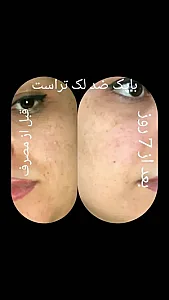 محصولات روتین مراقبتی پوست ومو