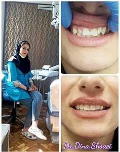 دندانپزشک دینا شعاعی