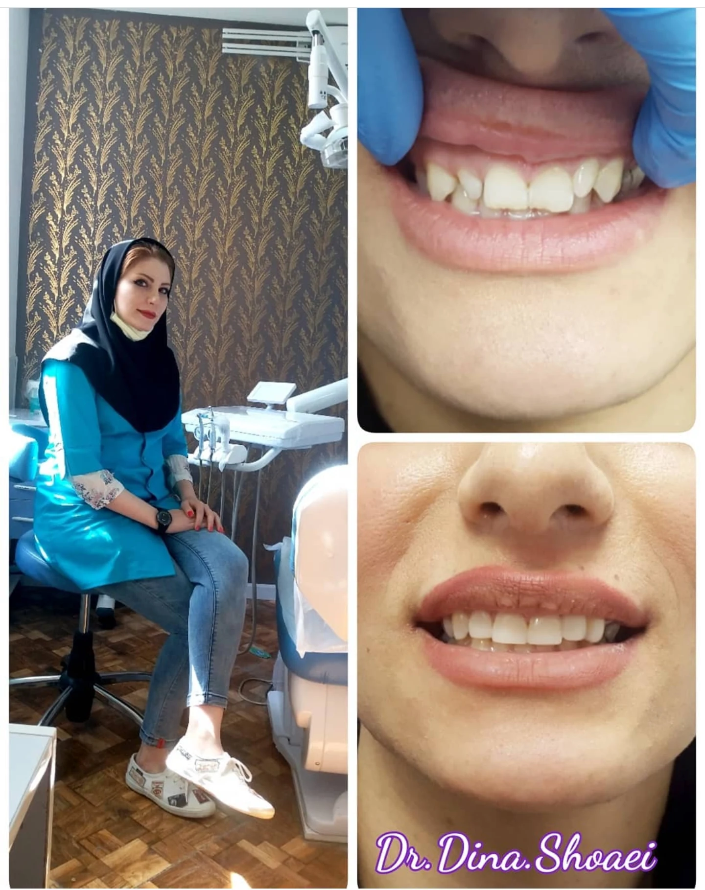 دندانپزشک دینا شعاعی - دندانپزشک در تهران