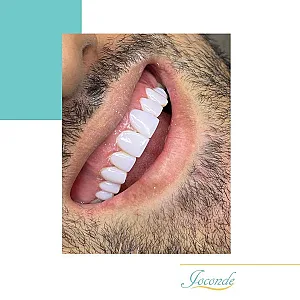 دندانپزشکی ژکوند