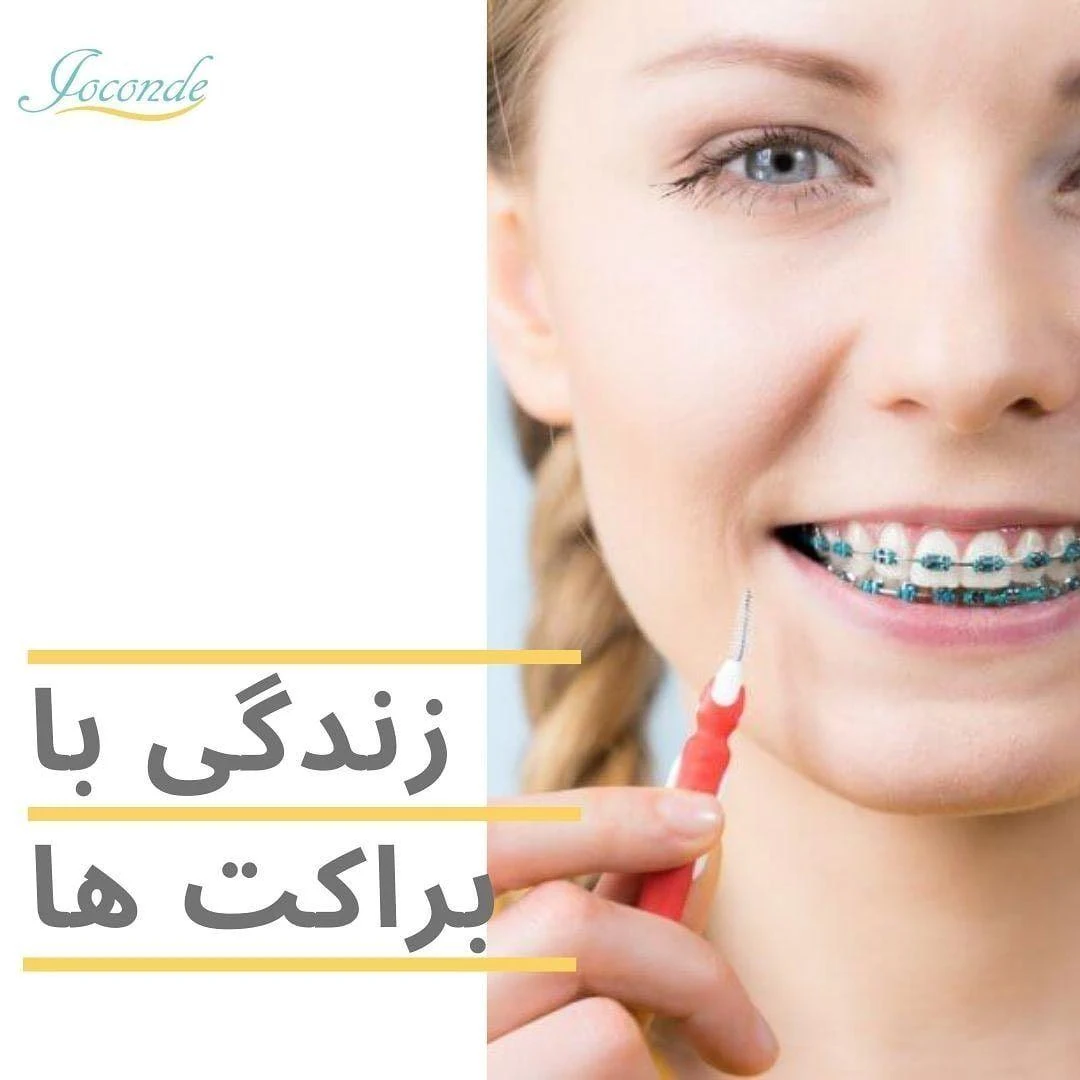 دندانپزشکی ژکوند - دندانپزشک در تهران - تصویر 3