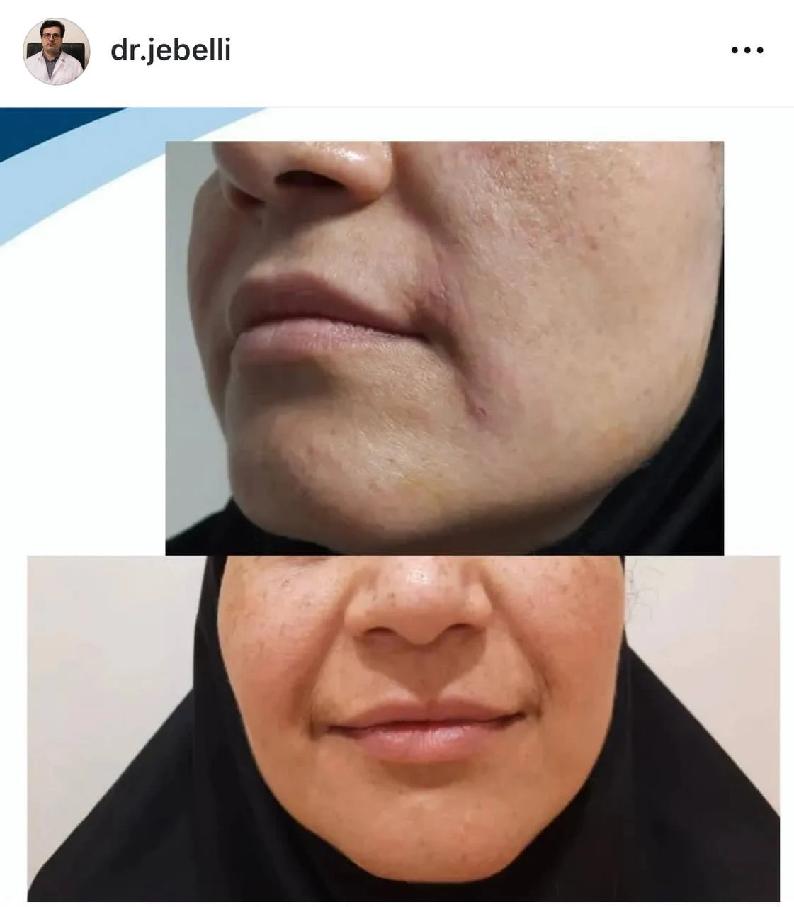 کلینیک زیبایی دکتر حمید رضا مخبریان - کلینیک پوست و زیبایی در تهران - تصویر 3