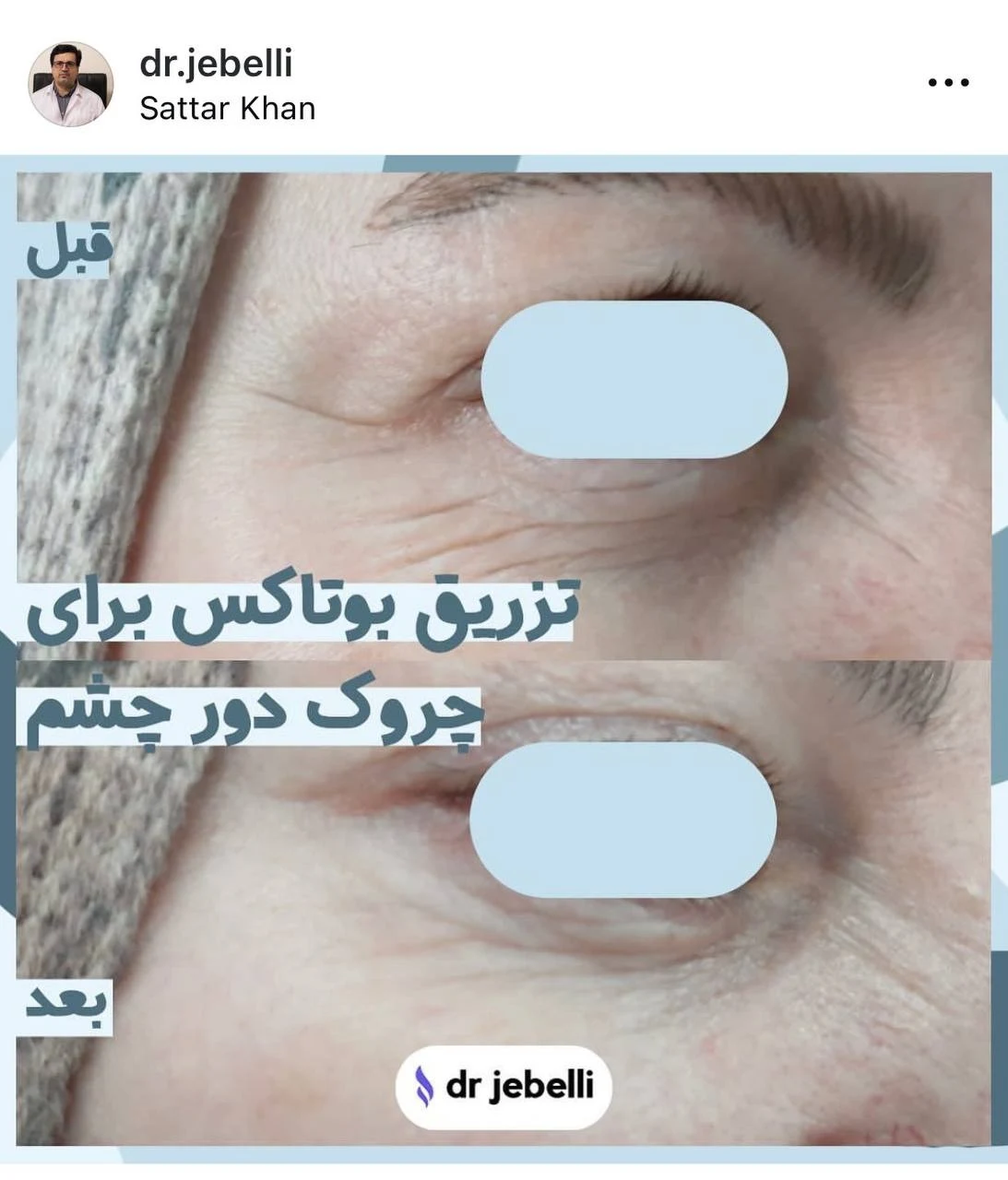 کلینیک زیبایی دکتر حمید رضا مخبریان - کلینیک پوست و زیبایی در تهران - تصویر 4