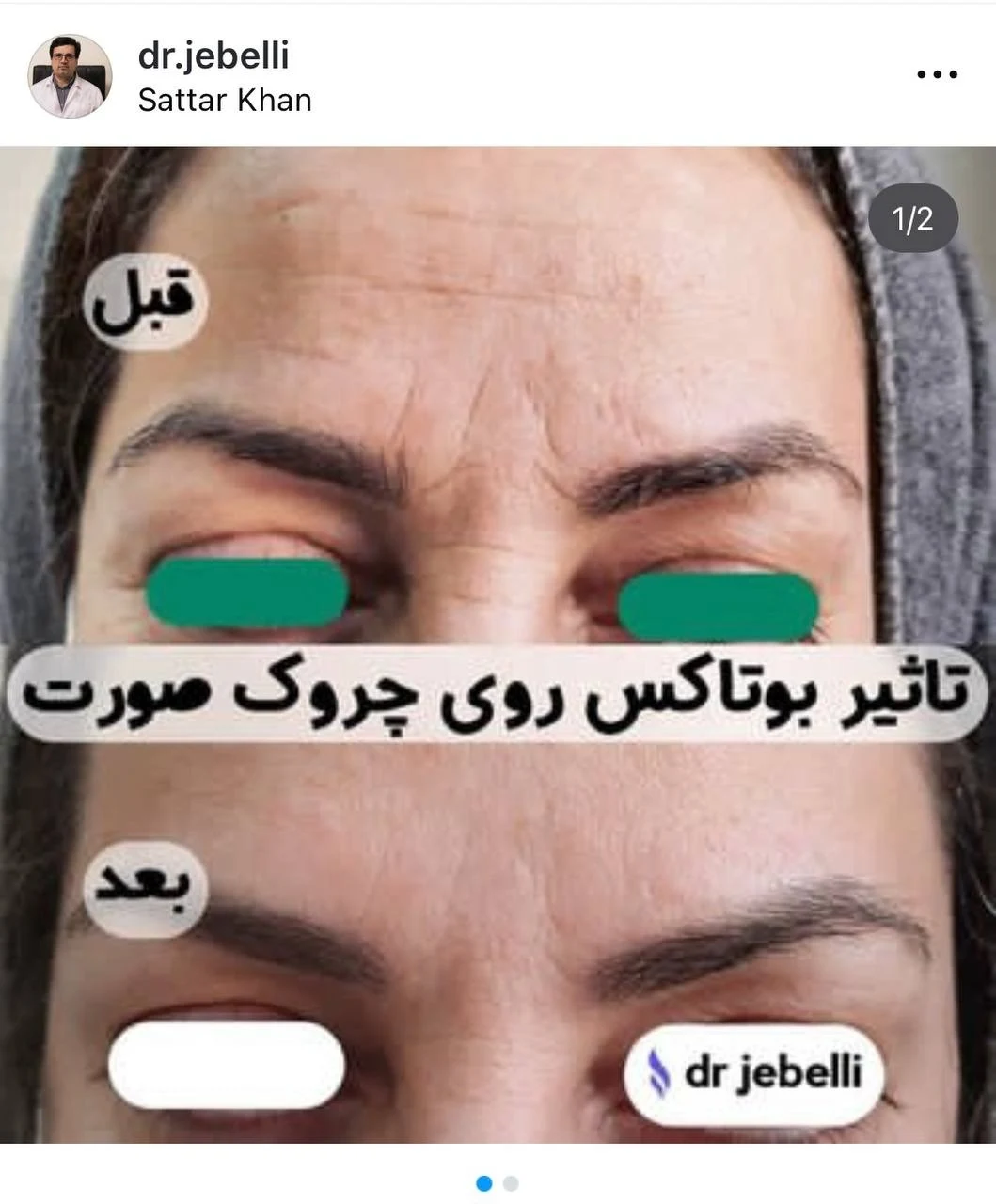 کلینیک زیبایی دکتر حمید رضا مخبریان - کلینیک پوست و زیبایی در تهران - تصویر 5