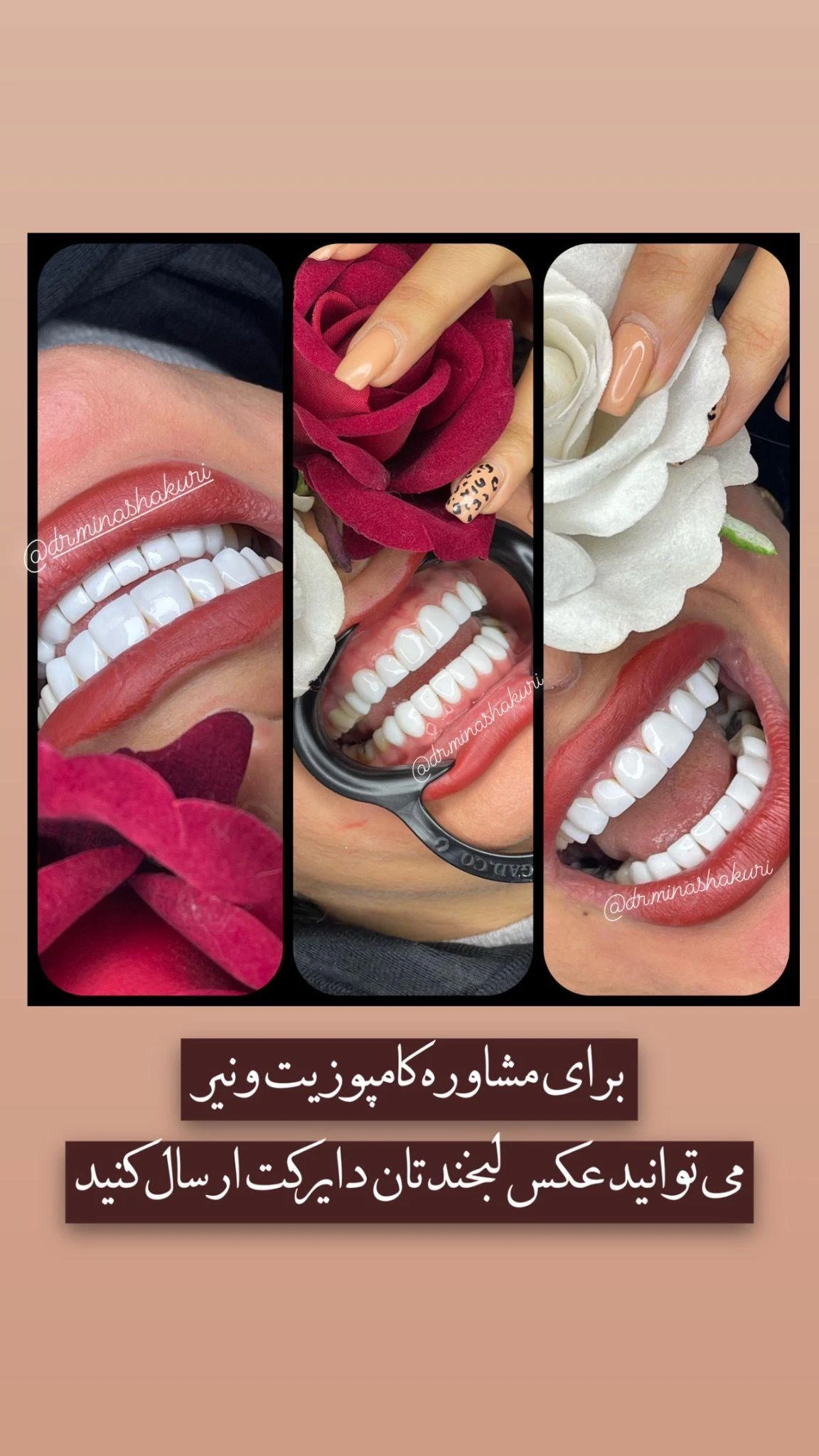 دندانپزشکی دنیز - دندانپزشک در تهران - تصویر 3