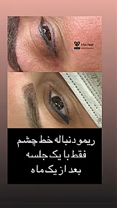 آکادمی ریموو تاتو سپیده رجب زاده