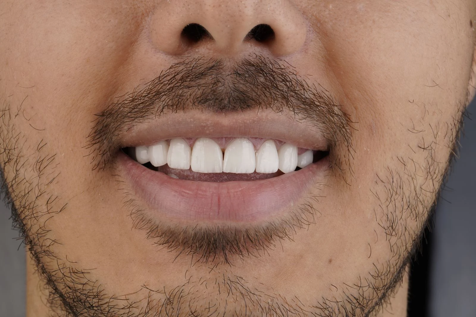 دندانپزشکی دکتر فائزه علی نژاد رودسری - دندانپزشک در تهران - تصویر 4