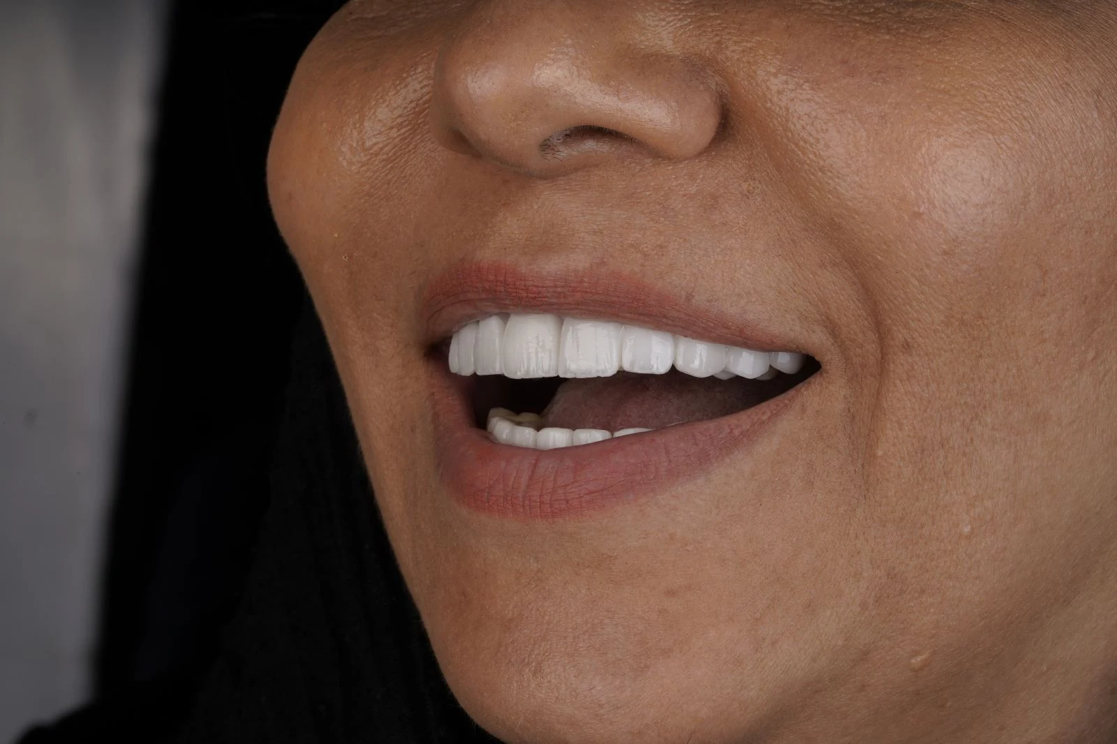 دندانپزشکی دکتر فائزه علی نژاد رودسری - دندانپزشک در تهران - تصویر 5