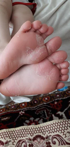 کلینیک پوست مو لیزر باران - تصویر 3