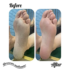 خدمات تخصصی ناخن رضوان