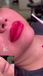 میکرو بلیدینگ رومینا نوبهاری