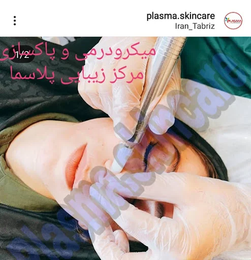 مرکز زیبایی و لاغری پلاسما