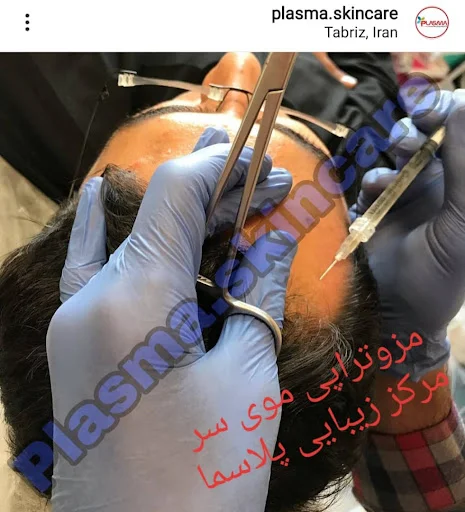 مرکز زیبایی و لاغری پلاسما