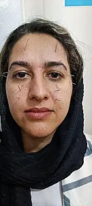 مرکز طب سوزنی نارمک دکتر فهیمی