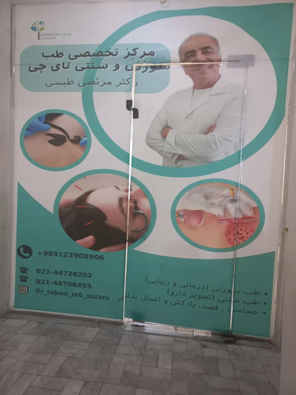 طب سوزنی دکتر طبسی - تصویر 2