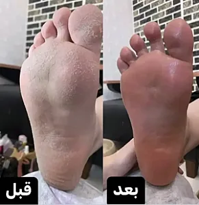 پدیکور غرب