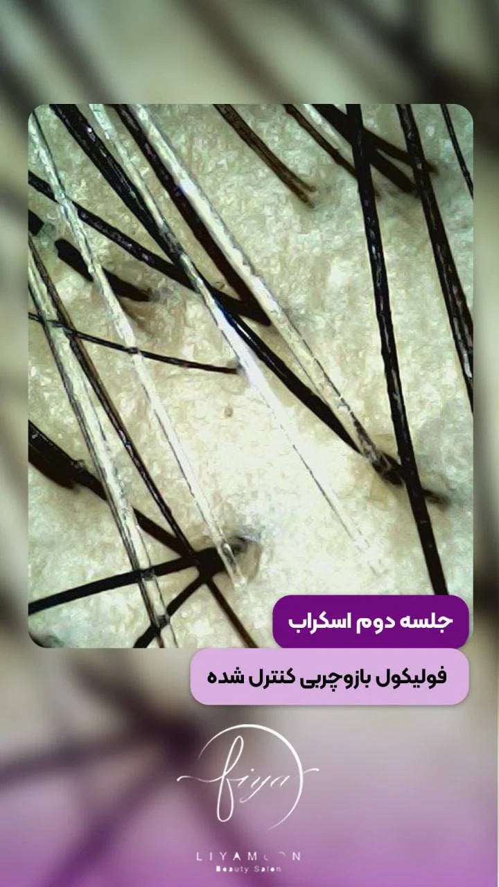 خانه زیبایی لیامون - آموزشگاه آرایشگری در تهران - تصویر 5