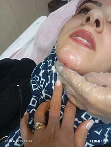 خدمات ژل و بوتاکس شقایق