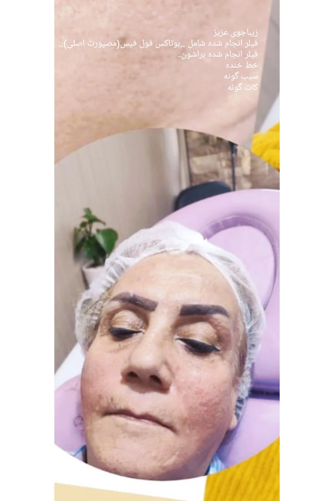 خدمات ژل و بوتاکس شقایق - کلینیک پوست و زیبایی در تهران - تصویر 2
