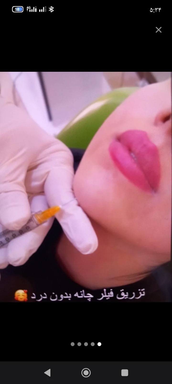 خدمات ژل و بوتاکس شقایق - کلینیک پوست و زیبایی در تهران - تصویر 3