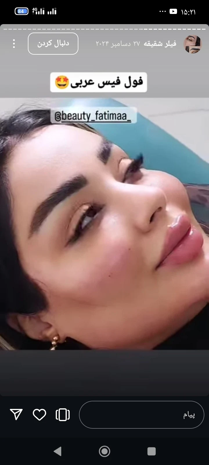خدمات ژل و بوتاکس شقایق - کلینیک پوست و زیبایی در تهران - تصویر 4