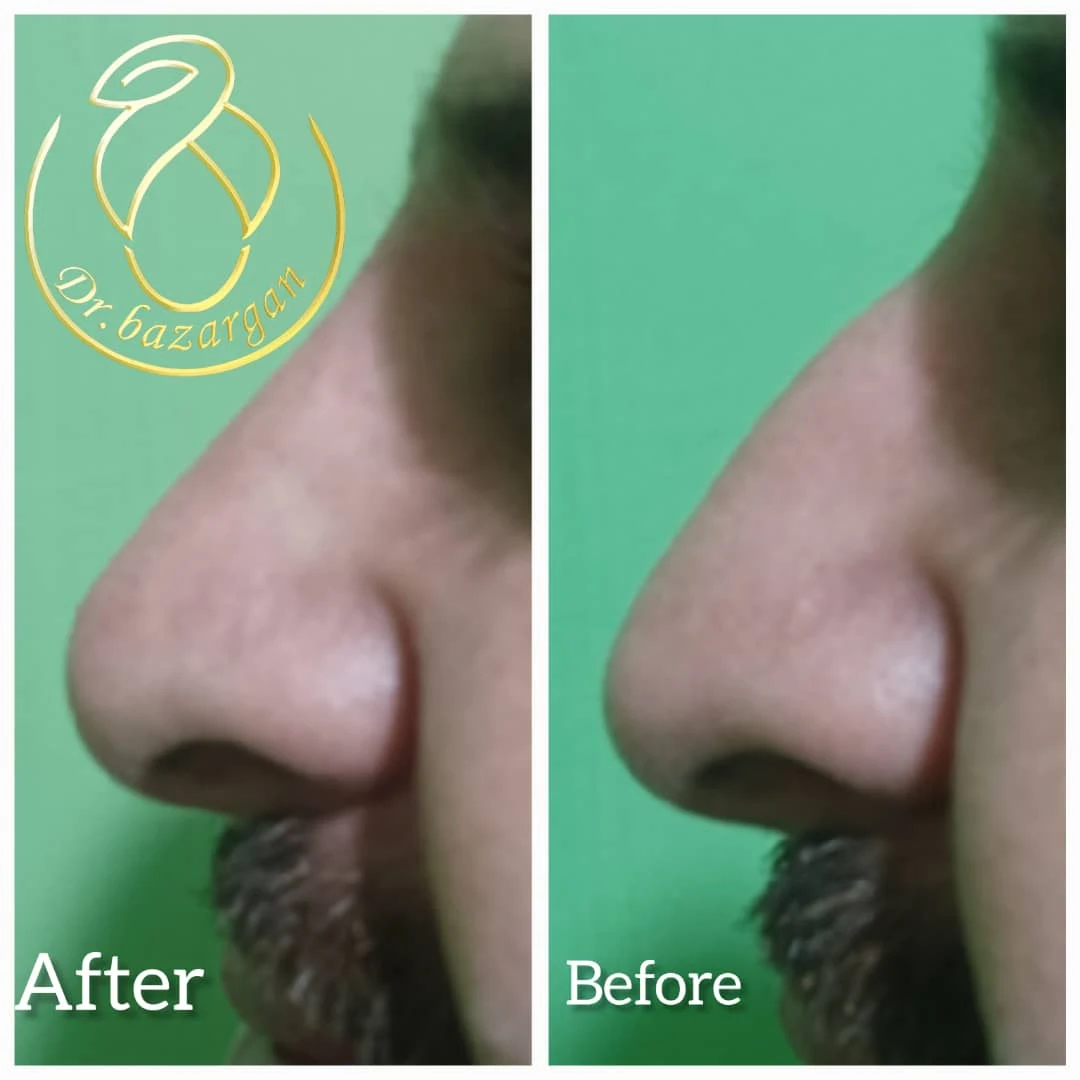مطب زیبایی دکتر مطهره مختارزاده بازرگان - کلینیک پوست و زیبایی در تهران - تصویر 2