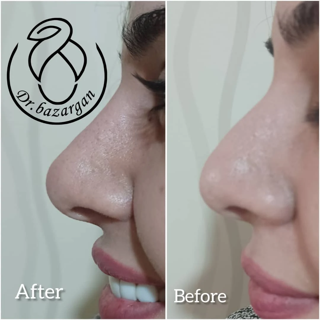 مطب زیبایی دکتر مطهره مختارزاده بازرگان - کلینیک پوست و زیبایی در تهران - تصویر 3