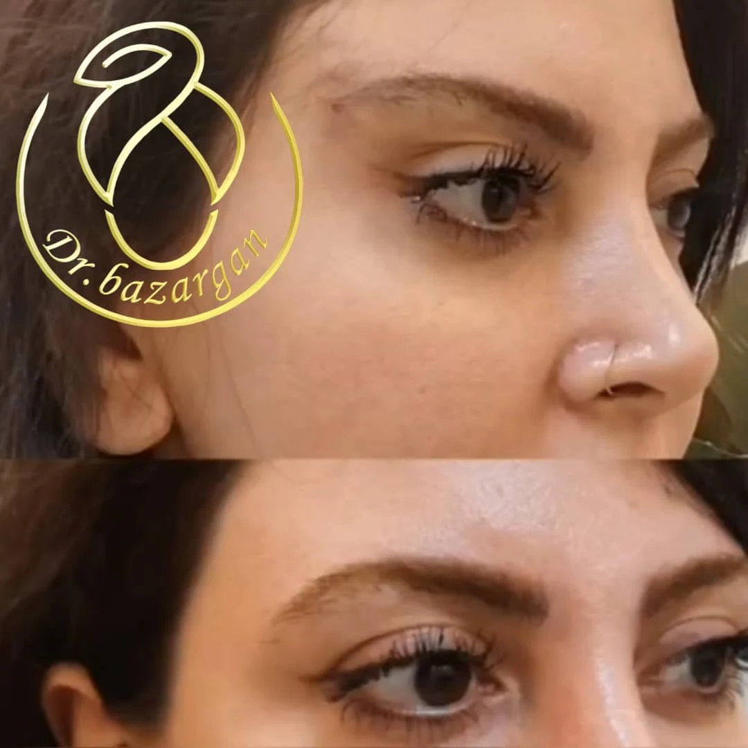 مطب زیبایی دکتر مطهره مختارزاده بازرگان - کلینیک پوست و زیبایی در تهران - تصویر 4