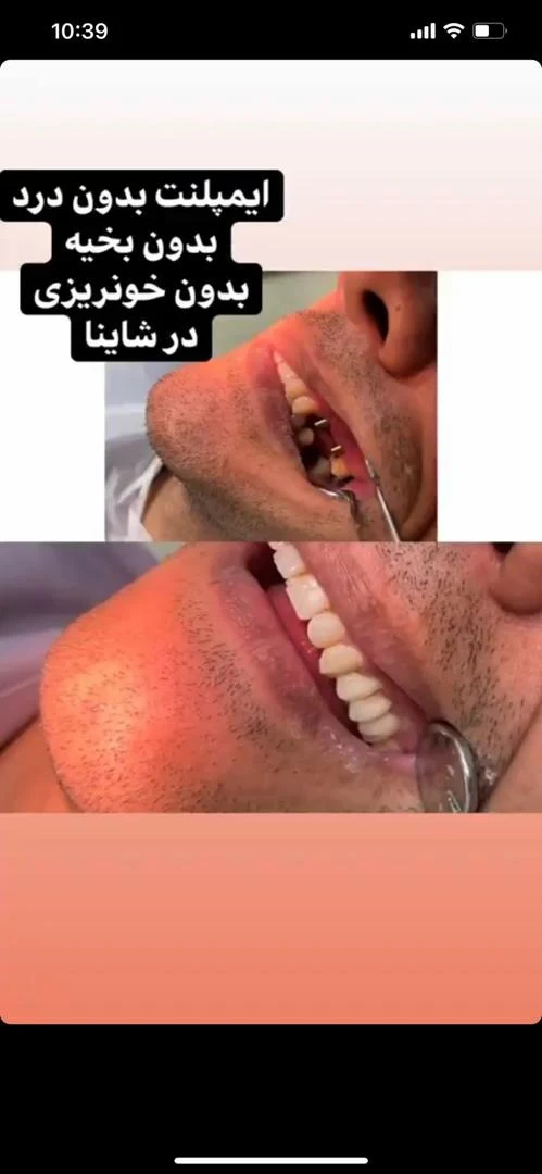 کلینیک دندانپزشکی شاینا - دندانپزشک در تهران - تصویر 2
